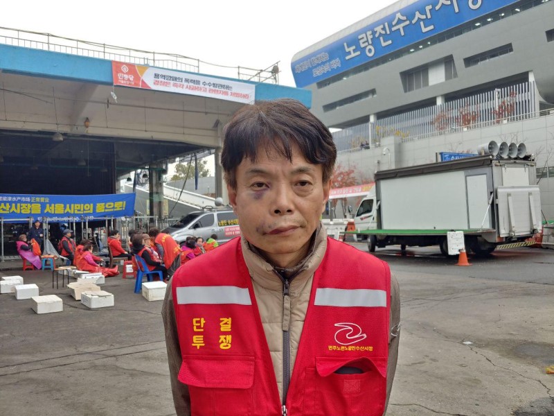수협 측과 충돌에 폭행당한 윤헌주 노량진수산시장 현대화비상대책총연합회 공동위원장의 모습.