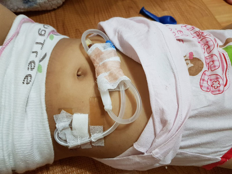복막투석을 하는 최은주 씨의 딸