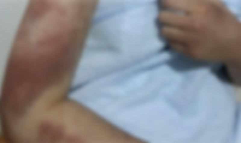 B(14)양 등 중고교생 10명은 지난달 26일부터 27일 이틀 동안 고등학교 2학년인 A양을 노래방과 관악산 일대에서 집단으로 폭행하고 추행한 혐의를 받고 있다.