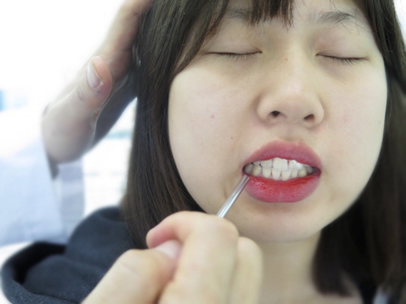 이갈이하거나 이를 악무는 습관이 있는 사람은 턱관절 장애를 일으킬 수 있다.(자료사진)