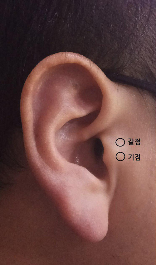 기점, 갈점