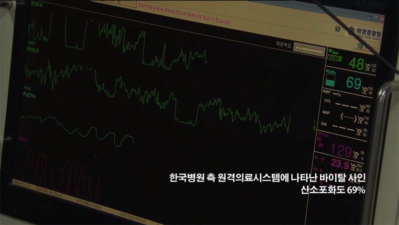 원격의료시스템에 뜬 산소포화도