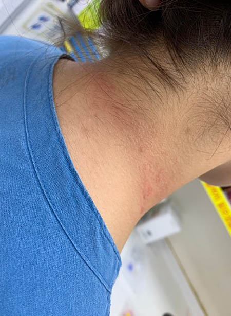 병원 근무를 하다 환자에게 목 졸린 간호사